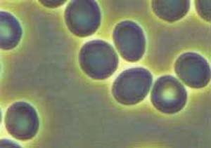 Live Blood Analysis picture