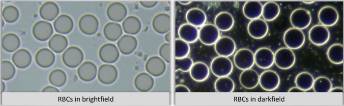 Your red blood cells (RBCs)